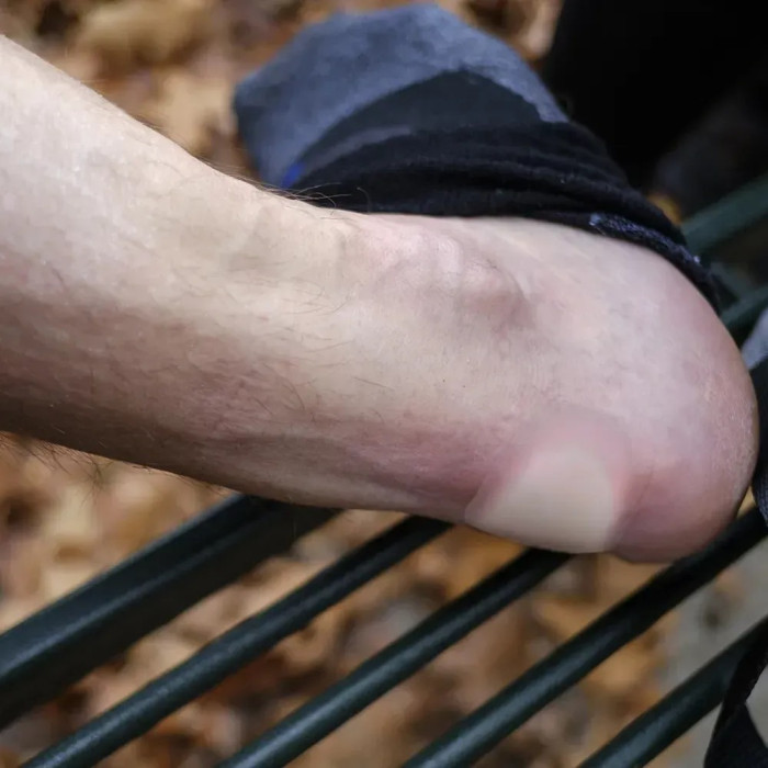 Набор пластырей Lifesystems Blister Plasters  